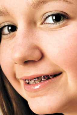 Healthy fangs are happy fangs