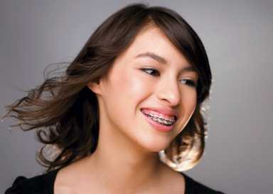Straighten up!: The pros and cons of braces