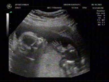 baby1hand