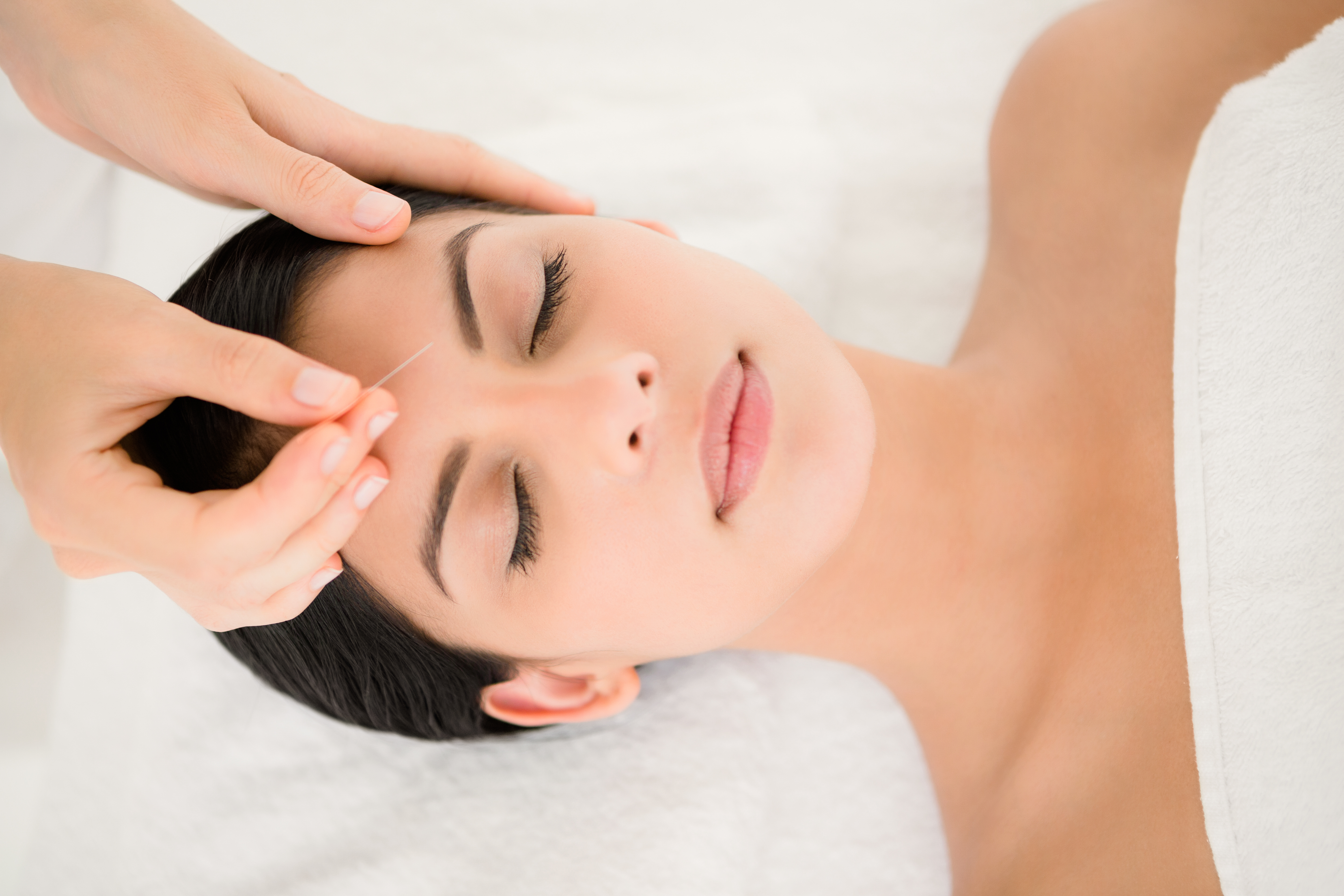 Woman in an acupuncture therapy