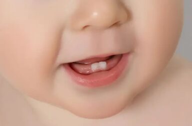 baby-teeth