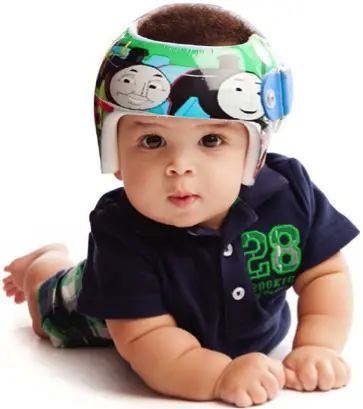 baby wearing cranial remodeling helmet