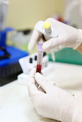 blood test in laboratory