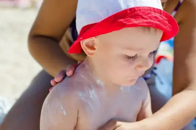 Tips to prevent sunburns