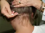 screening-for-head-lice
